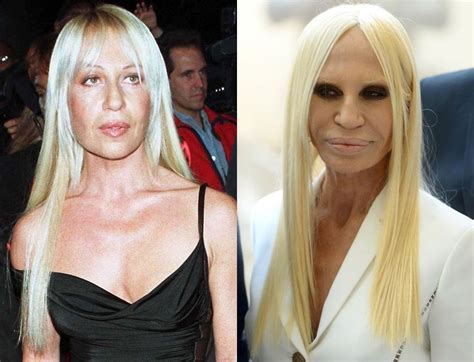 donatella versace before after|early photos of donatella versace.